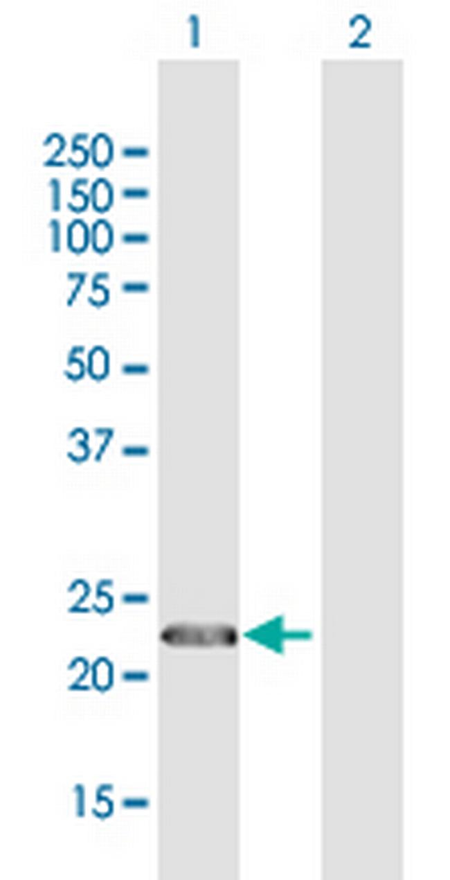 CENPN Antibody in Western Blot (WB)