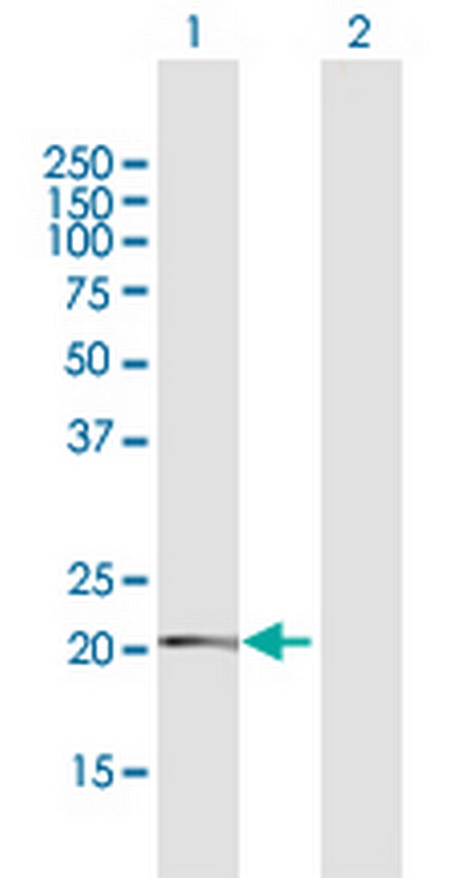 TMEM126B Antibody in Western Blot (WB)
