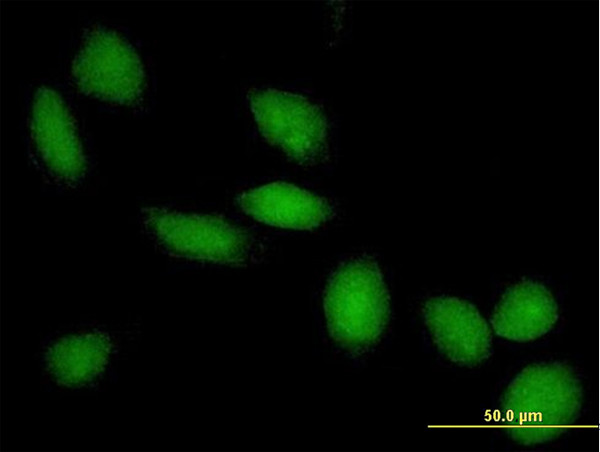 HDAC8 Antibody in Immunocytochemistry (ICC/IF)