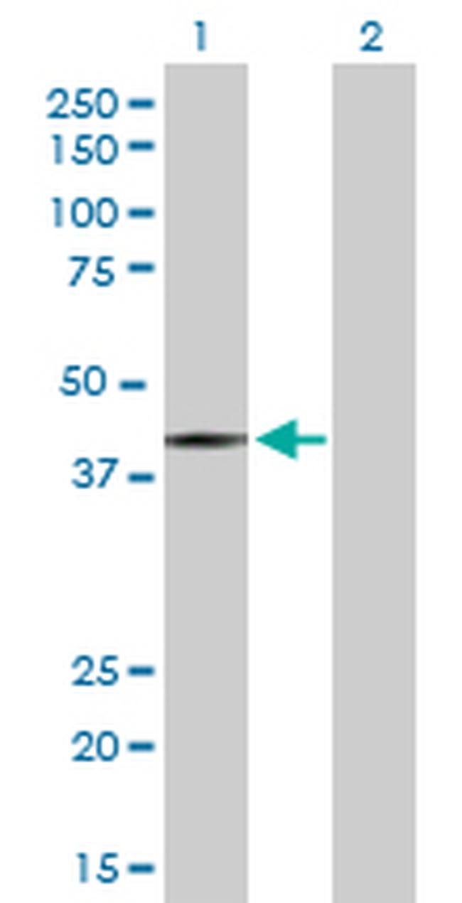HDAC8 Antibody in Western Blot (WB)