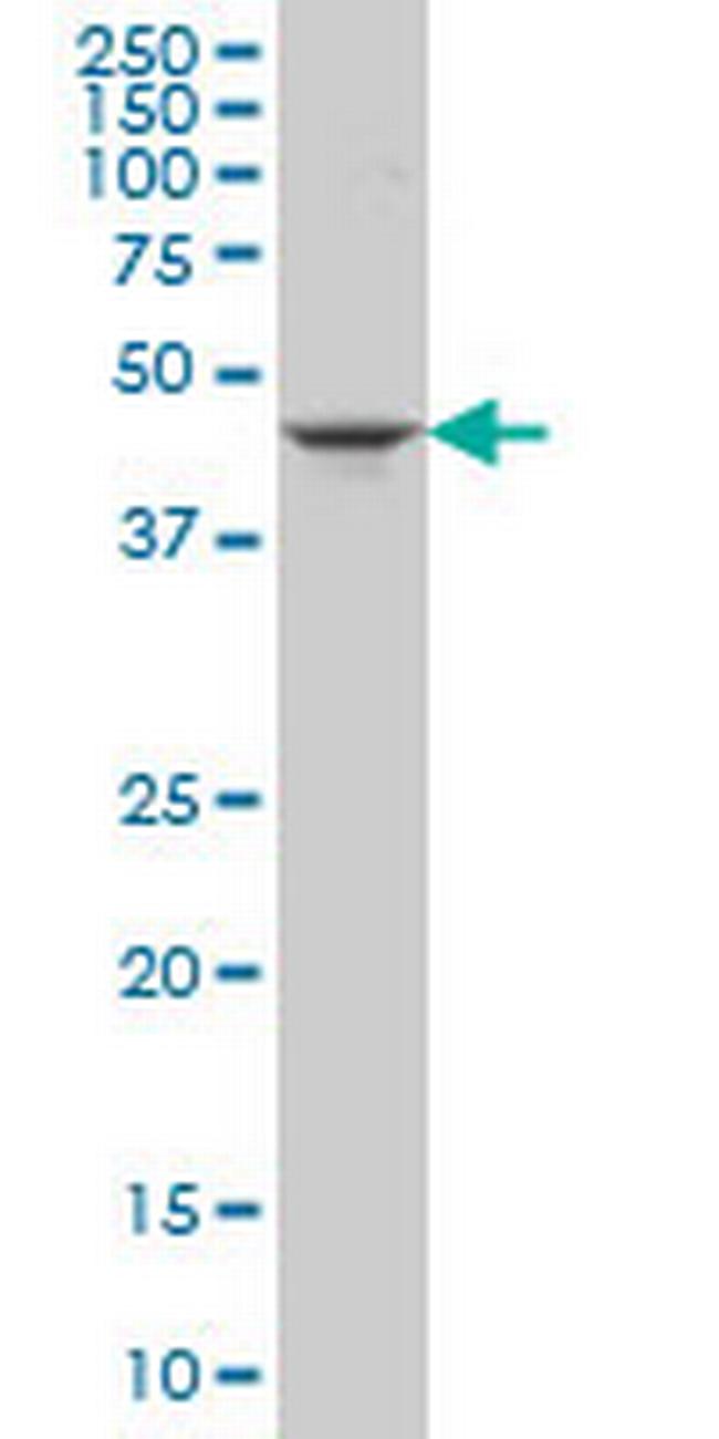 GSDML Antibody in Western Blot (WB)