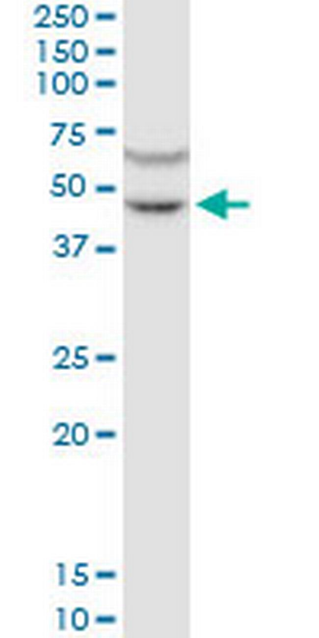 GPRC5C Antibody in Western Blot (WB)