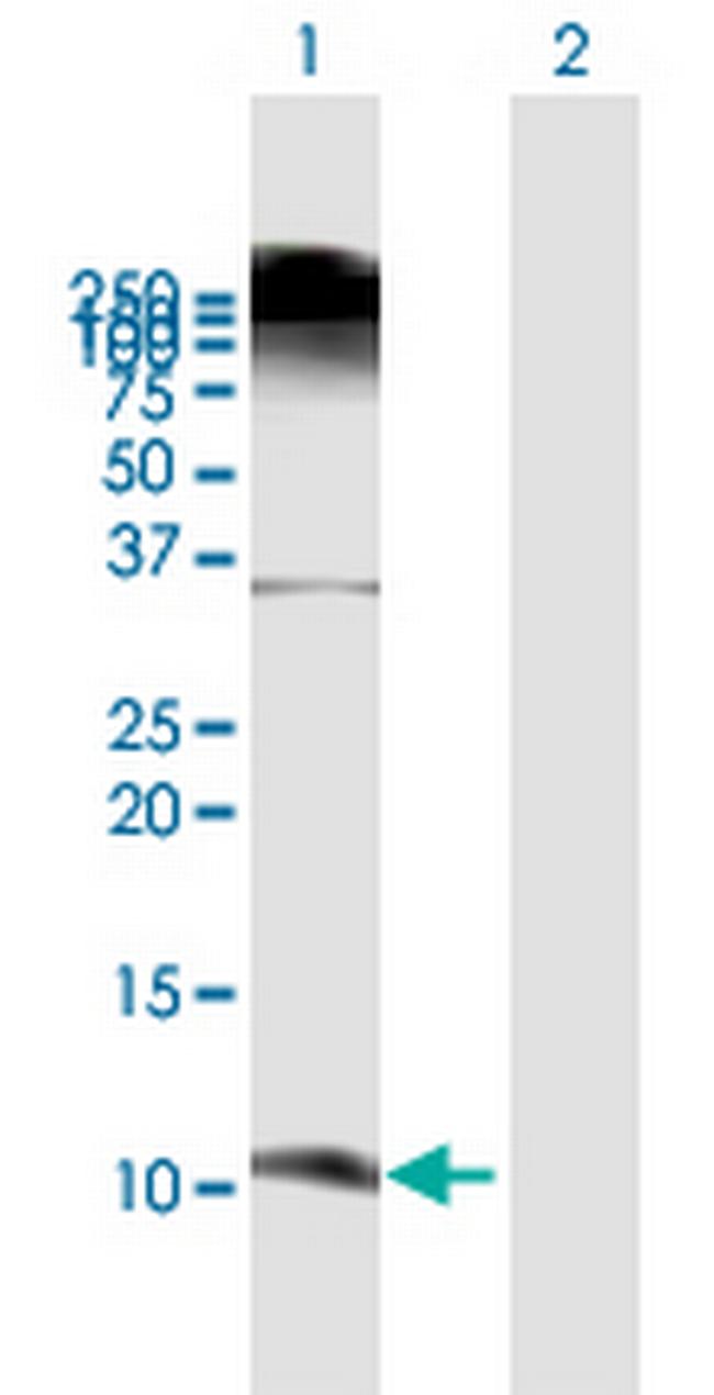 DEFB103A Antibody in Western Blot (WB)
