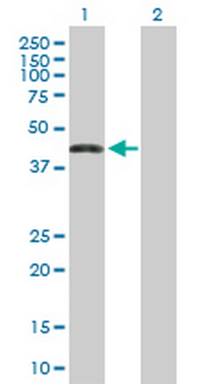 ZNF302 Antibody in Western Blot (WB)