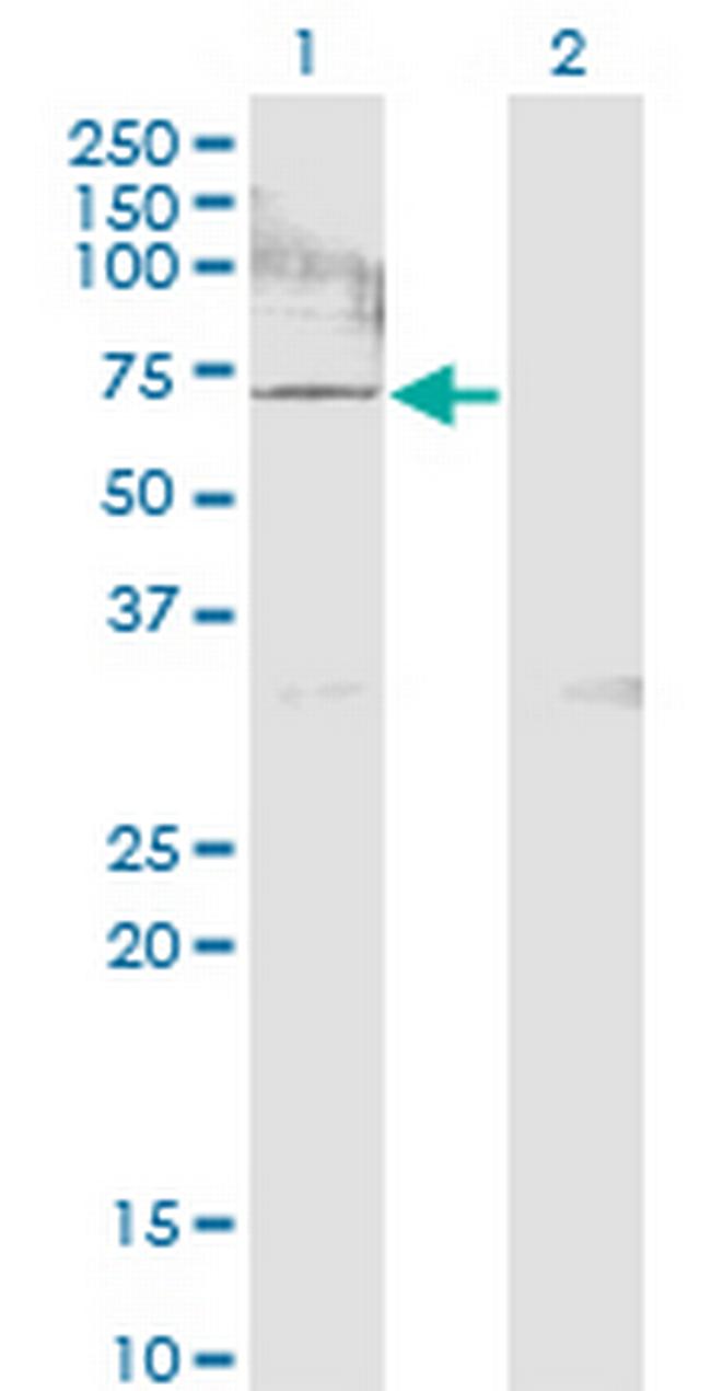 ACSS2 Antibody in Western Blot (WB)