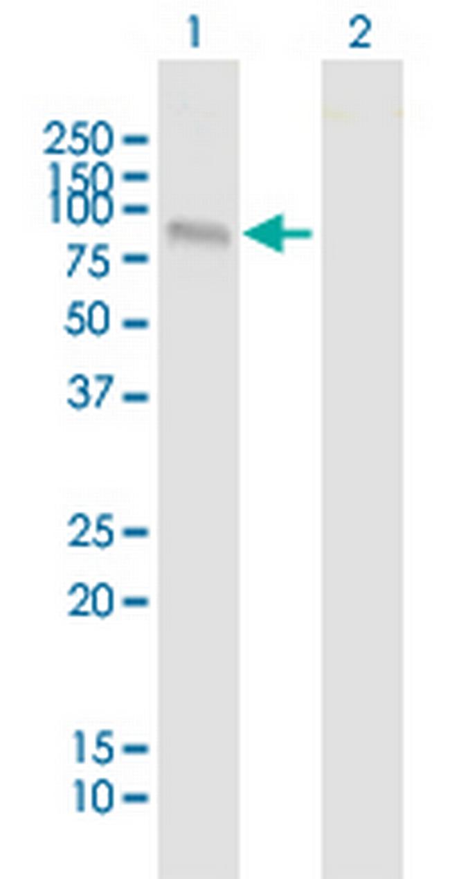 MLL5 Antibody in Western Blot (WB)