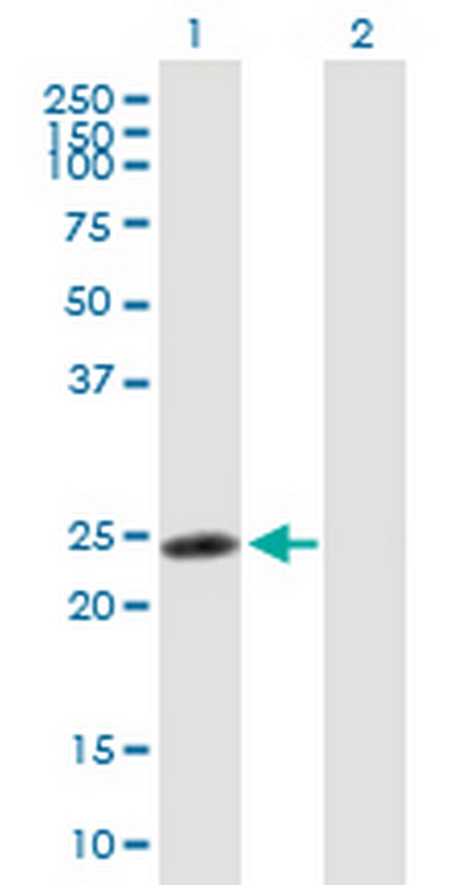 RNF114 Antibody in Western Blot (WB)