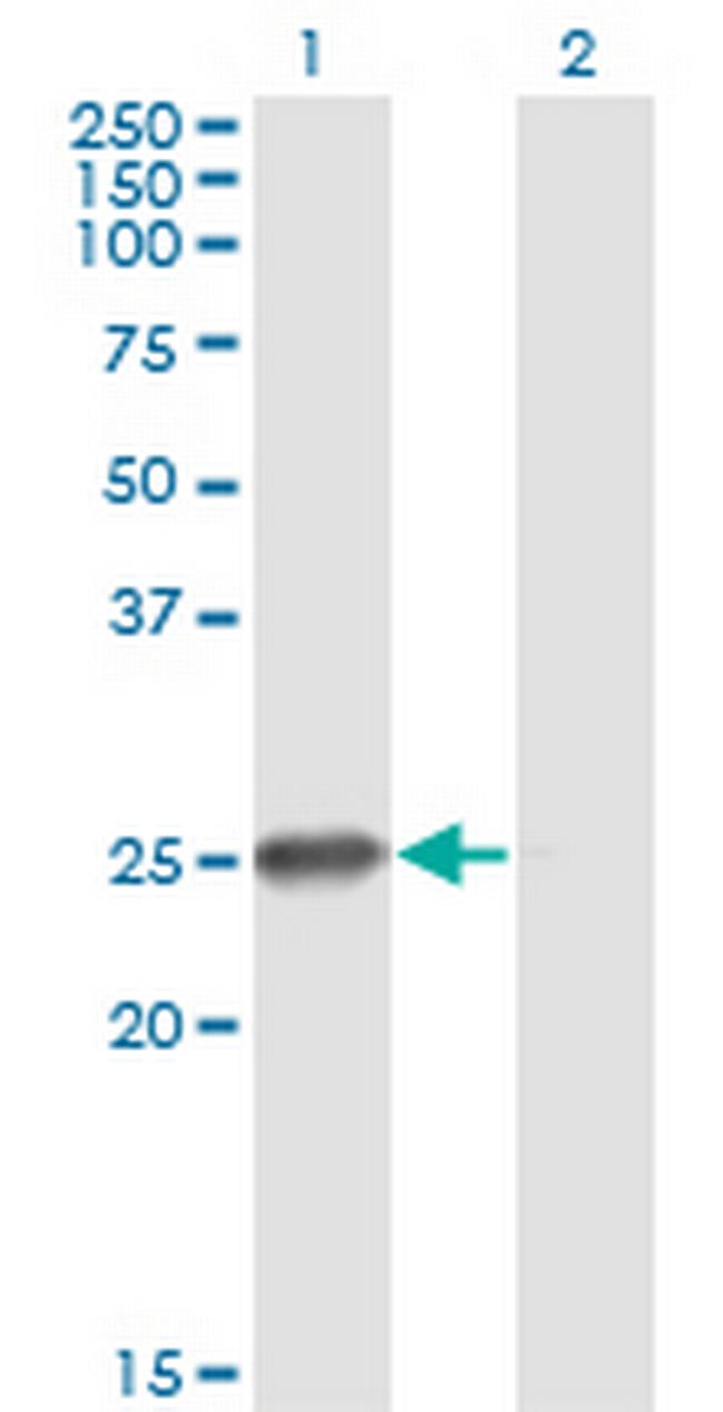 ZNF313 Antibody in Western Blot (WB)