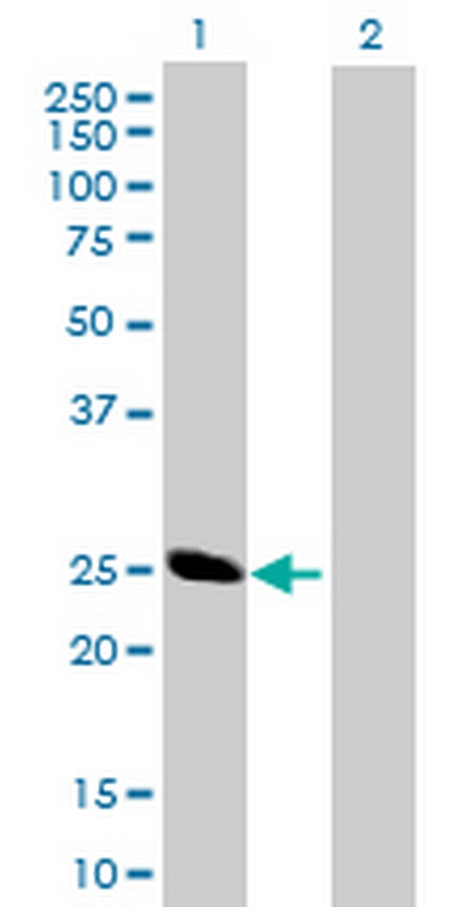 BCAP29 Antibody in Western Blot (WB)