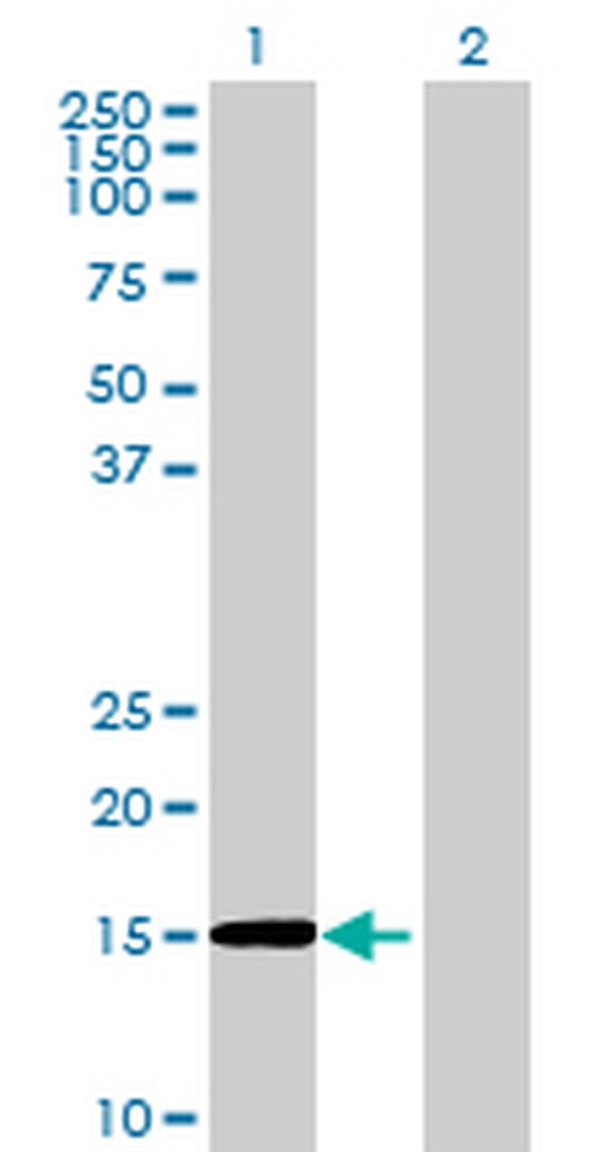 RAG1AP1 Antibody in Western Blot (WB)