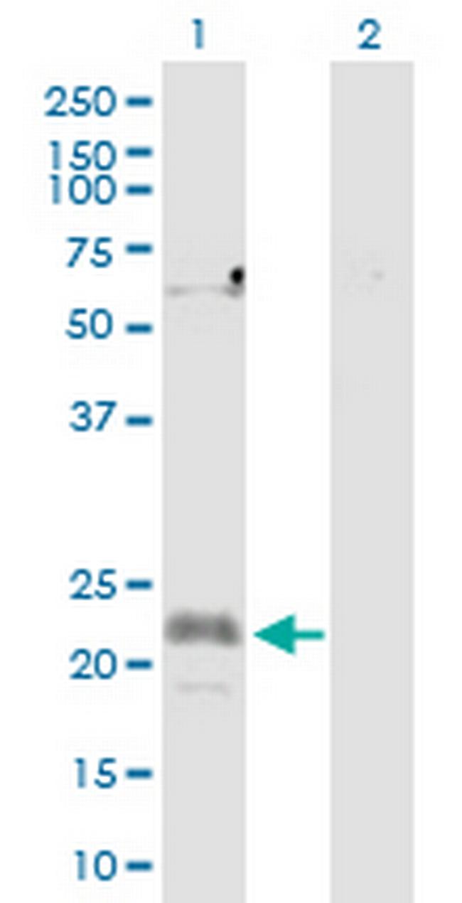 CFC1 Antibody in Western Blot (WB)