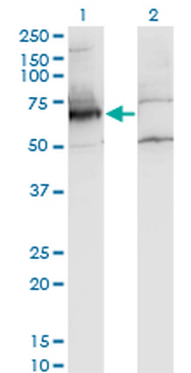 NXF2 Antibody in Western Blot (WB)