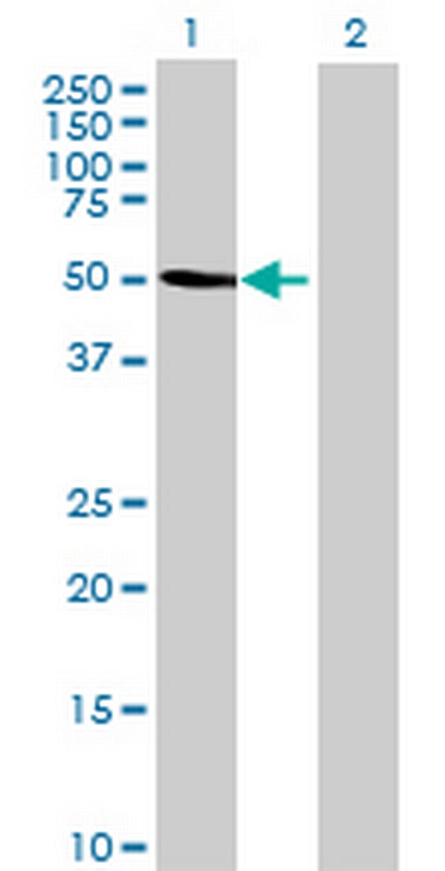 ALG1 Antibody in Western Blot (WB)