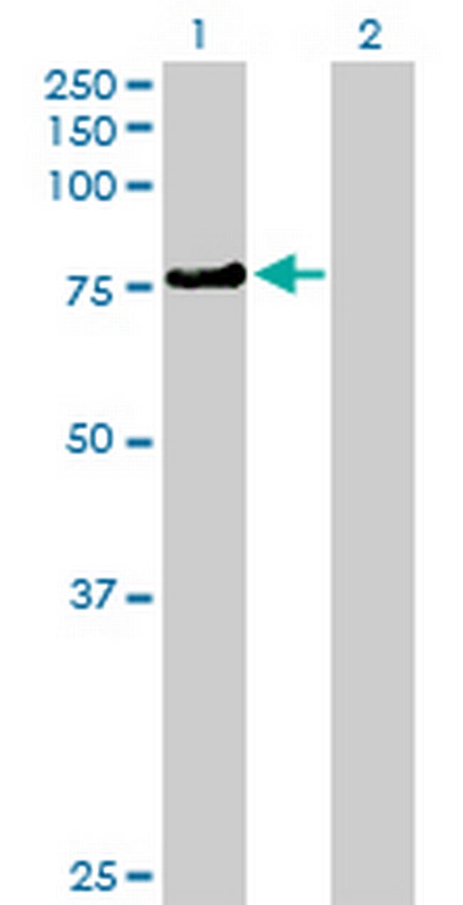 KLHL4 Antibody in Western Blot (WB)
