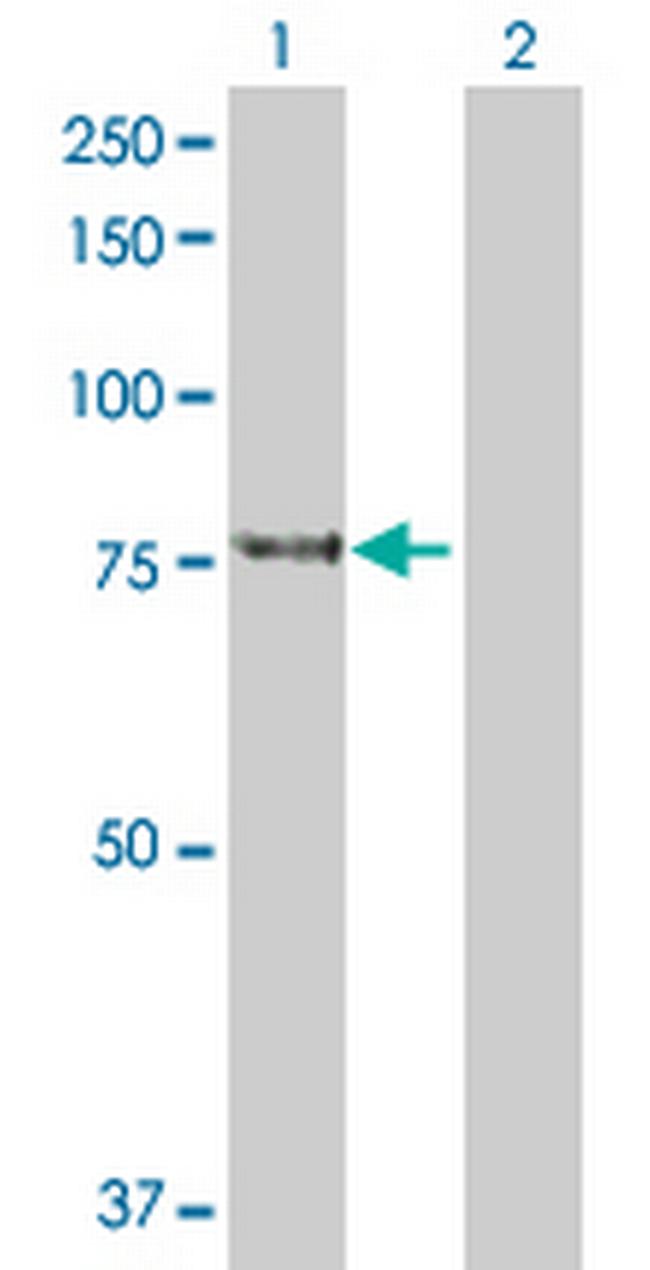 KLHL4 Antibody in Western Blot (WB)