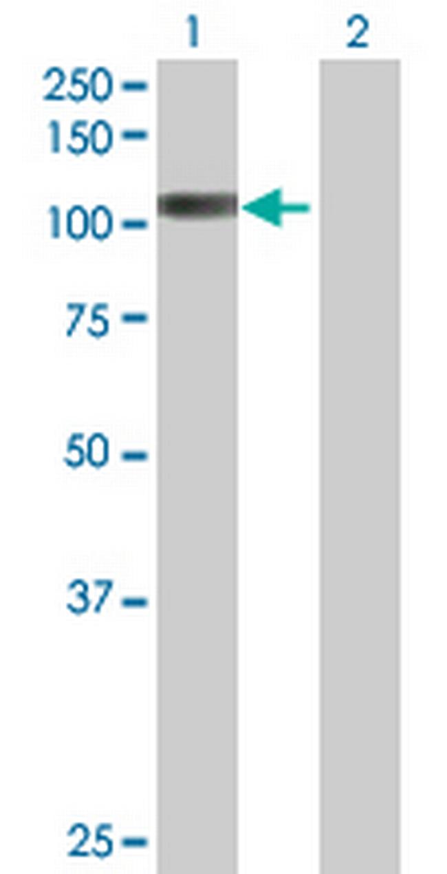 PCDHB6 Antibody in Western Blot (WB)