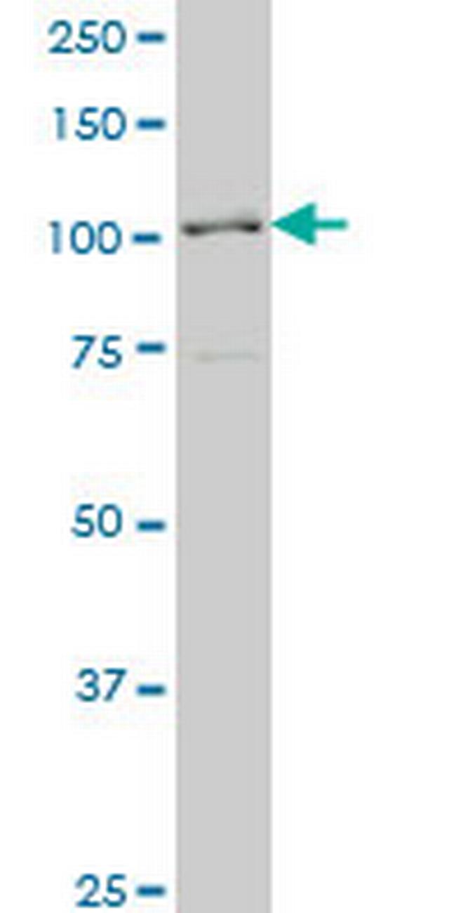 PCDHA6 Antibody in Western Blot (WB)