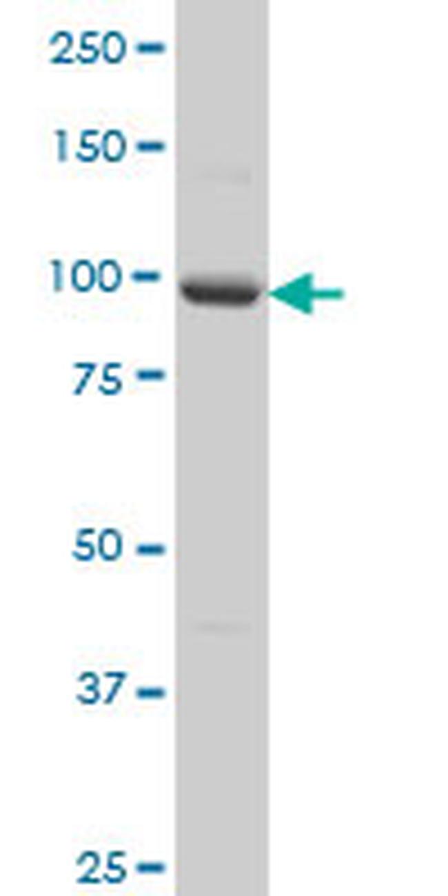 PCDHA5 Antibody in Western Blot (WB)