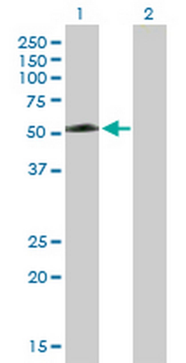 TEX13A Antibody in Western Blot (WB)