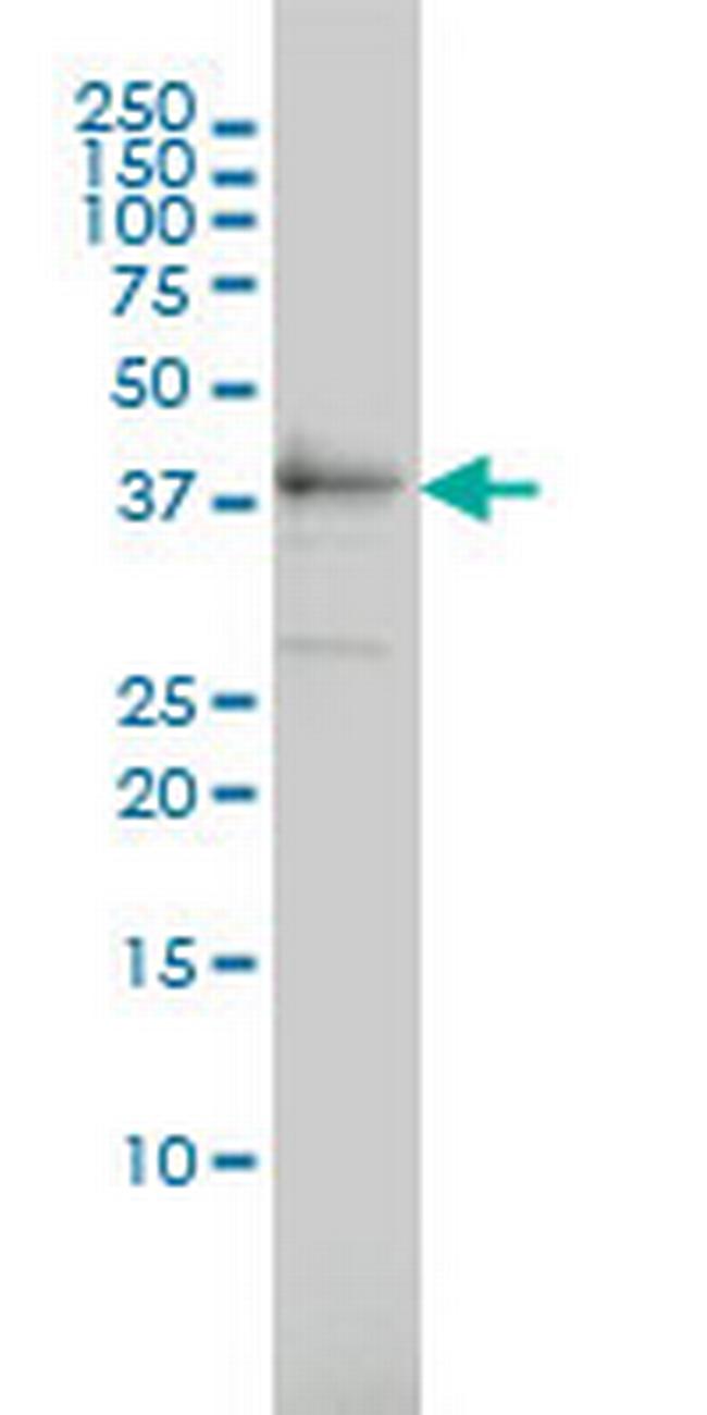 TEX13A Antibody in Western Blot (WB)
