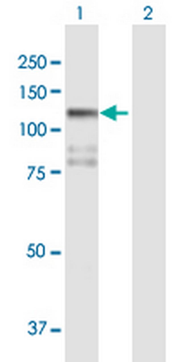 STK31 Antibody in Western Blot (WB)