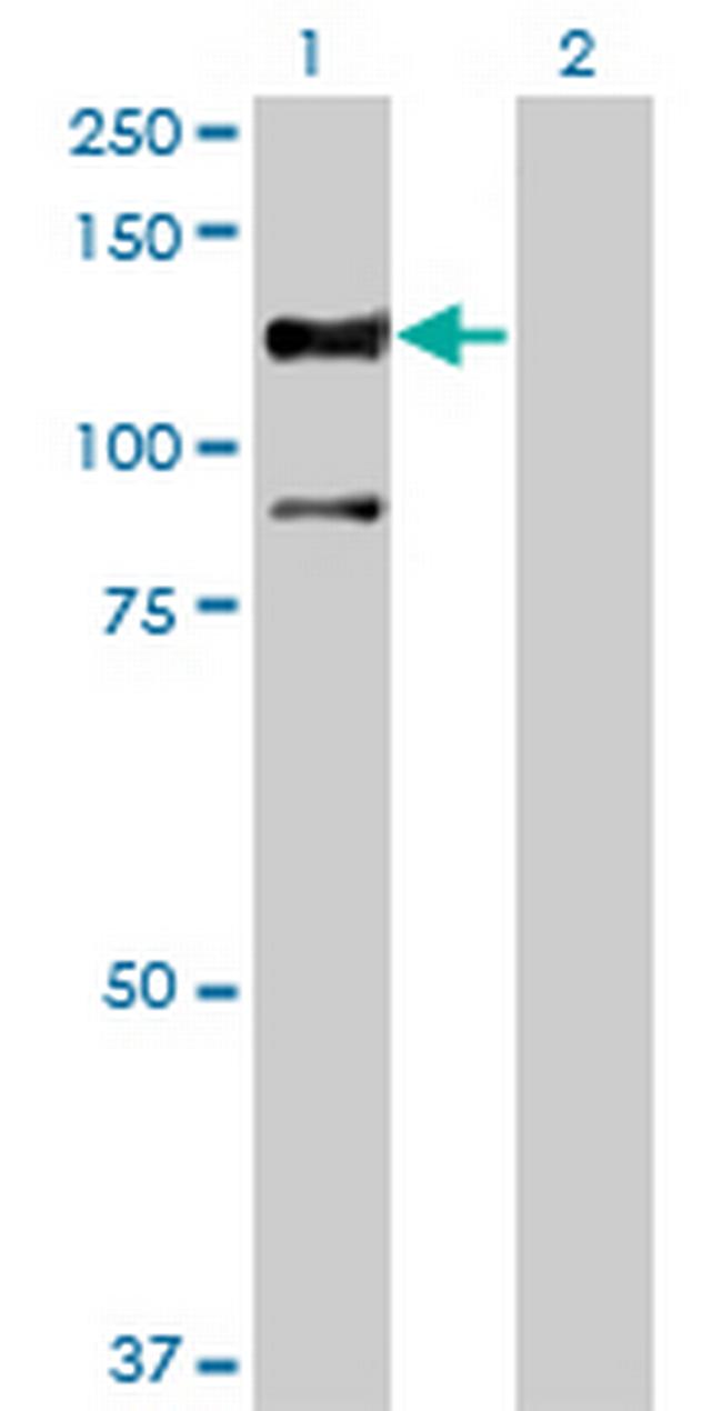 STK31 Antibody in Western Blot (WB)