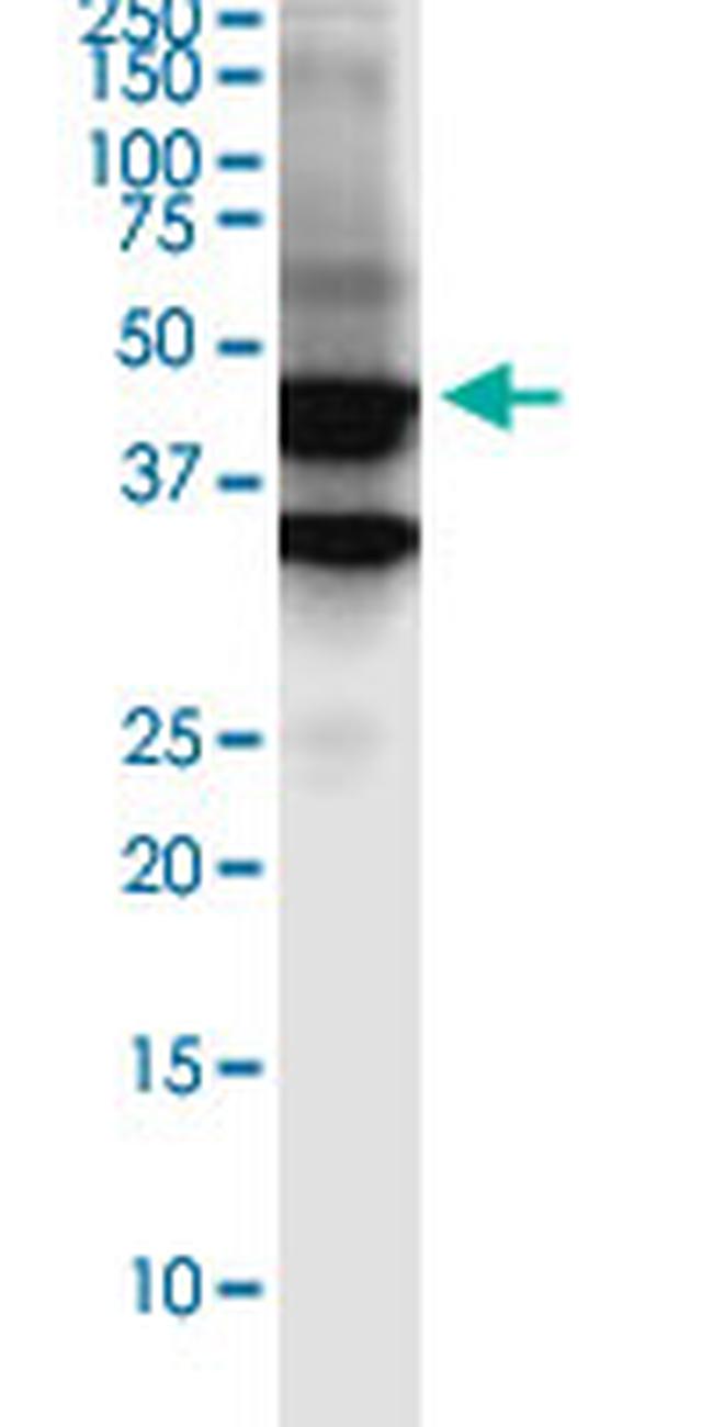 SERTAD4 Antibody in Western Blot (WB)