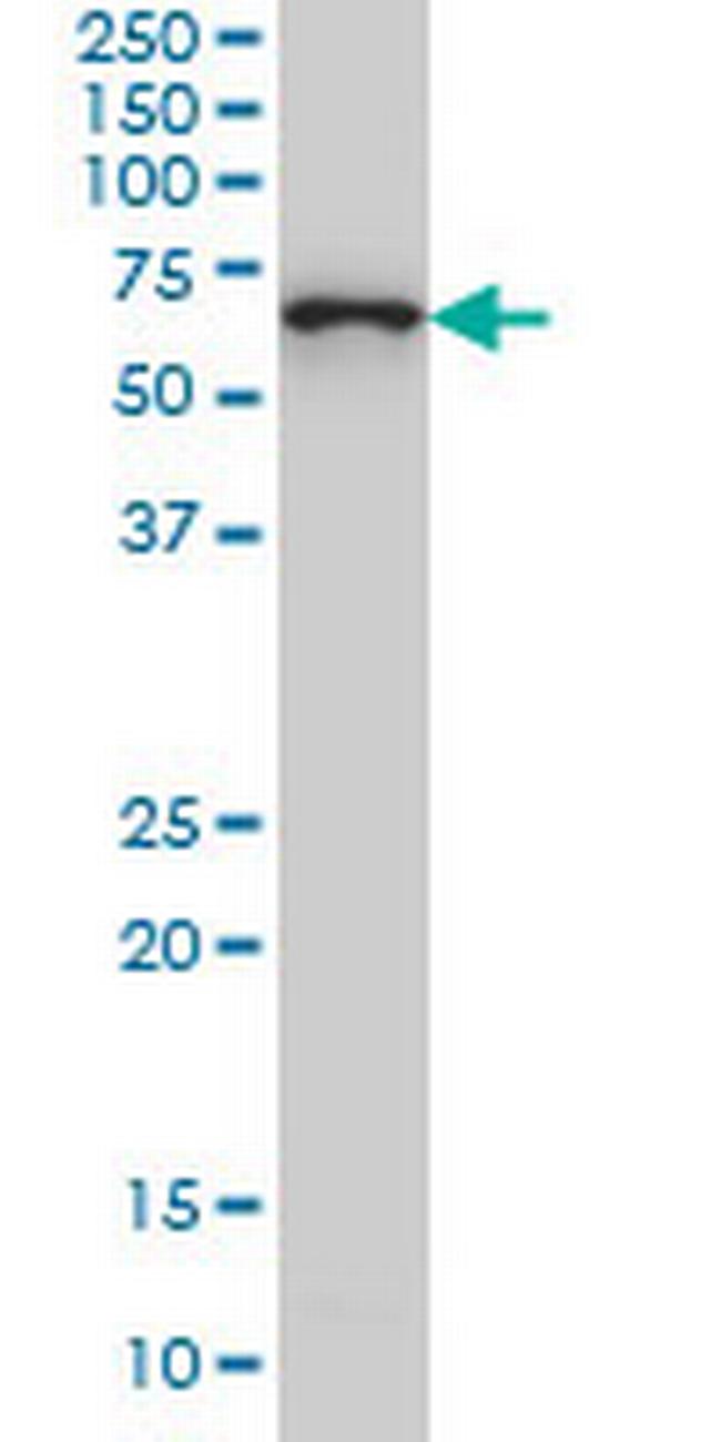 CTNNBL1 Antibody in Western Blot (WB)