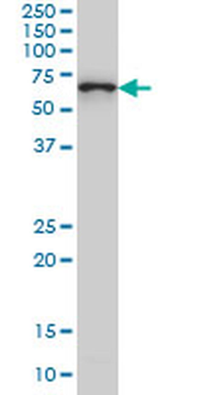 CTNNBL1 Antibody in Western Blot (WB)
