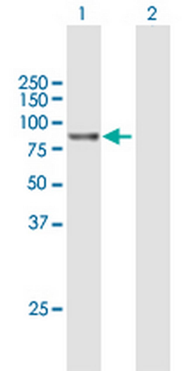 RP5-1022P6.2 Antibody in Western Blot (WB)