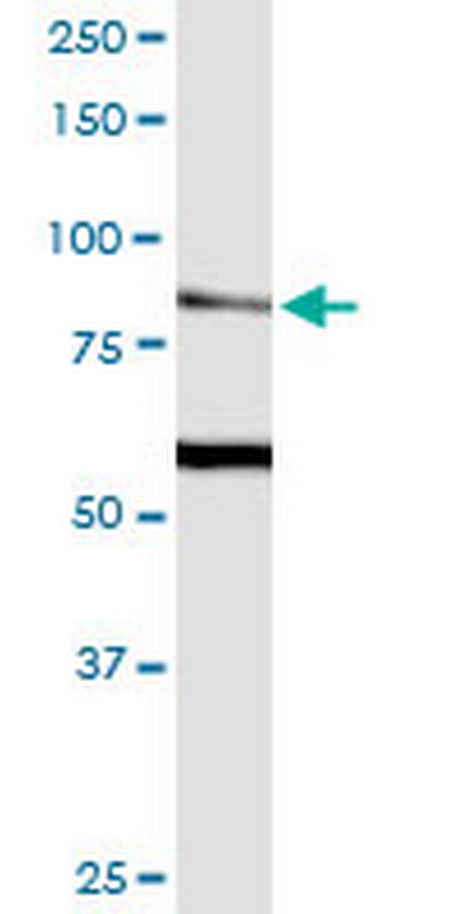 TRPV5 Antibody in Western Blot (WB)