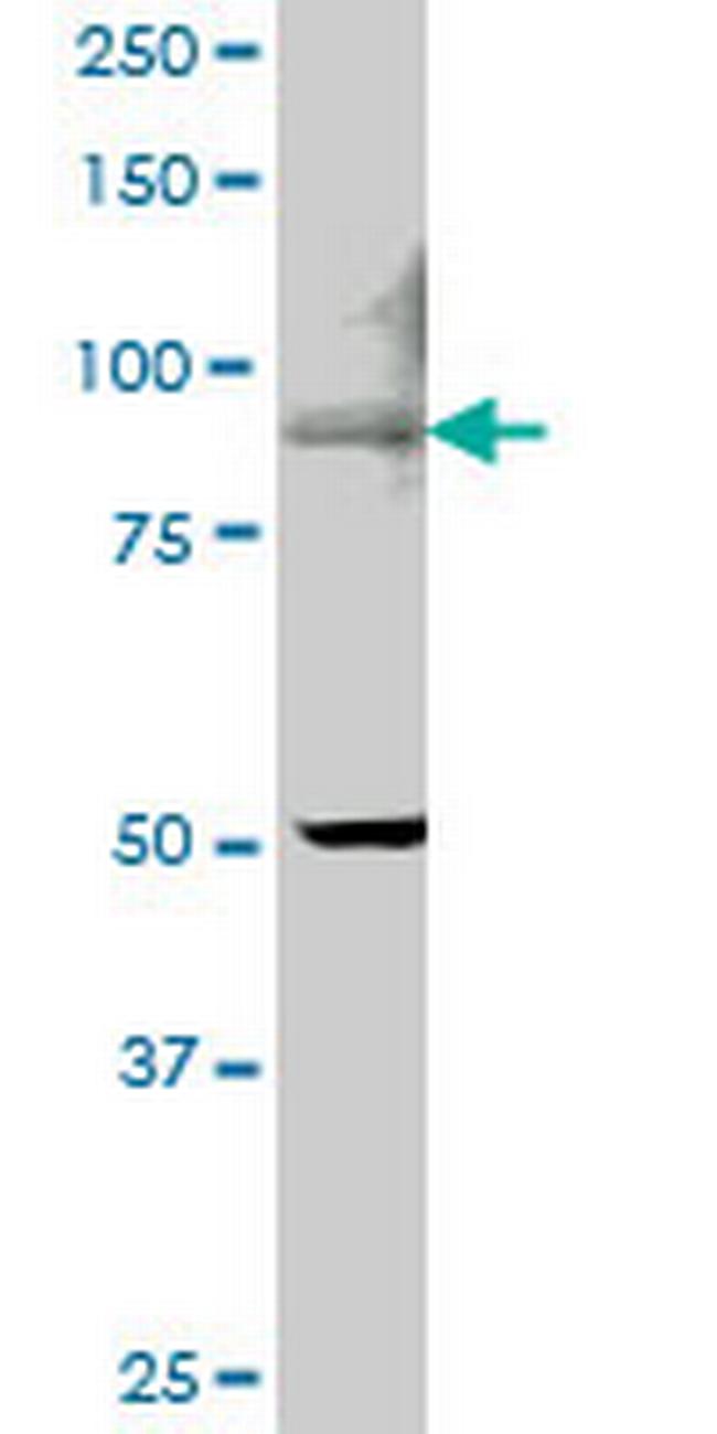TRPV5 Antibody in Western Blot (WB)
