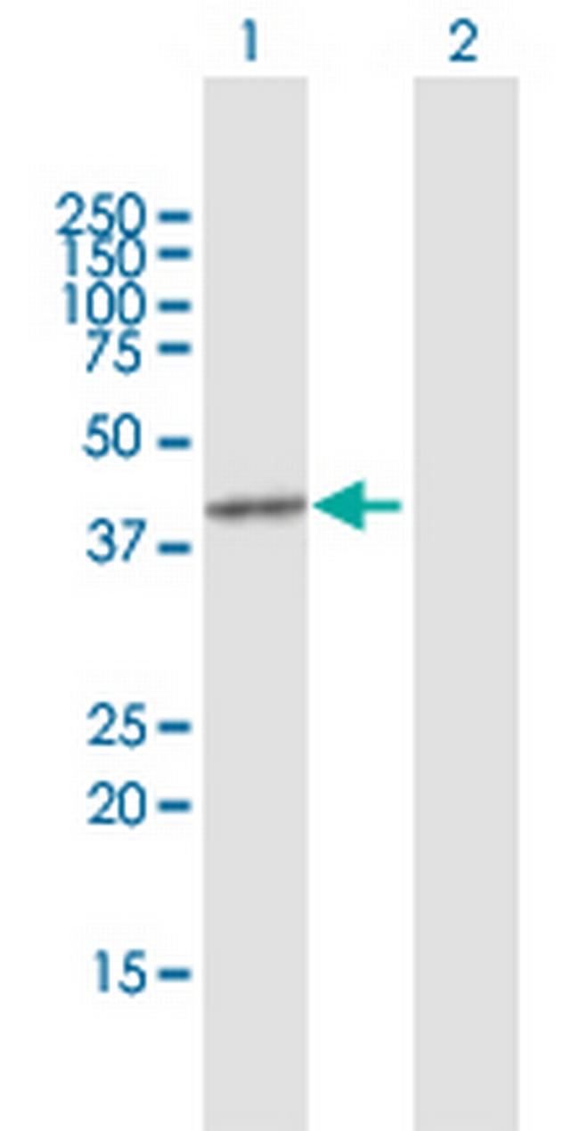 PRMT8 Antibody in Western Blot (WB)