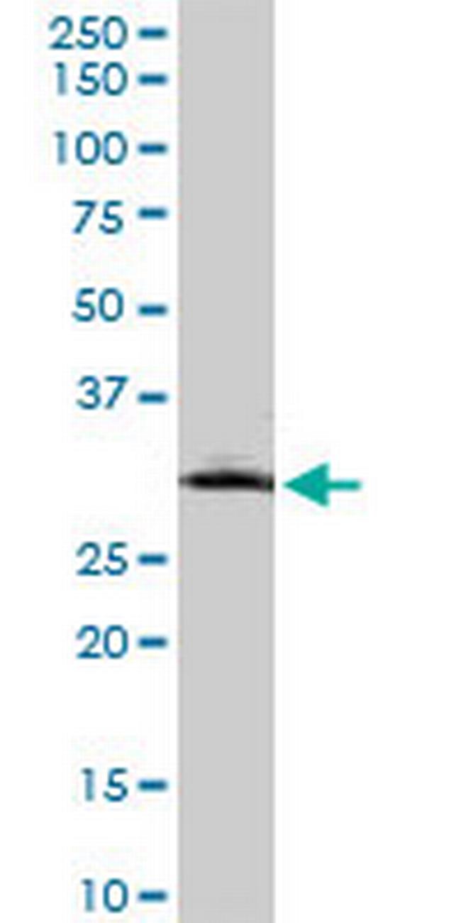 MMP26 Antibody in Western Blot (WB)