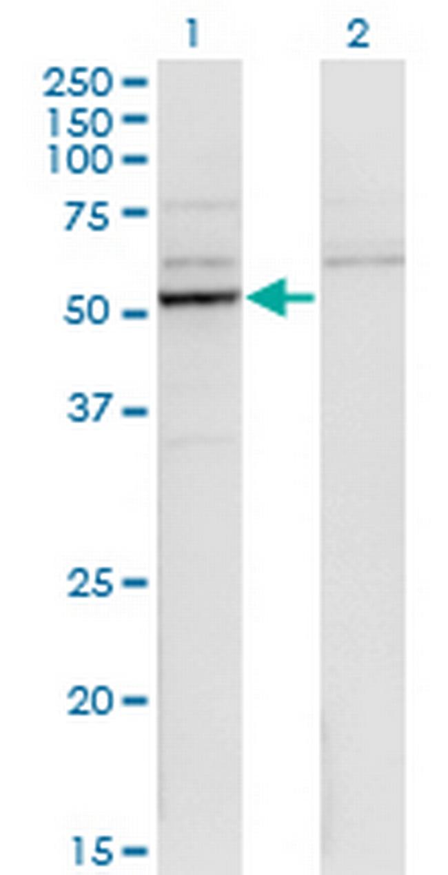 CYP26B1 Antibody in Western Blot (WB)