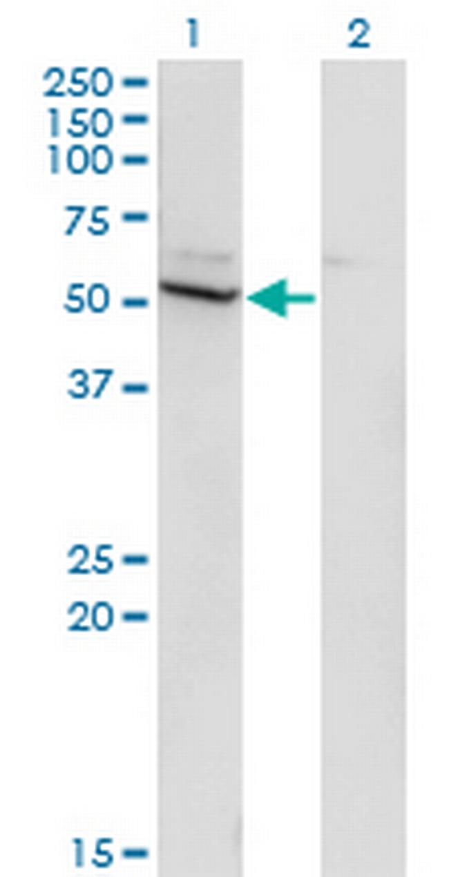 CYP26B1 Antibody in Western Blot (WB)