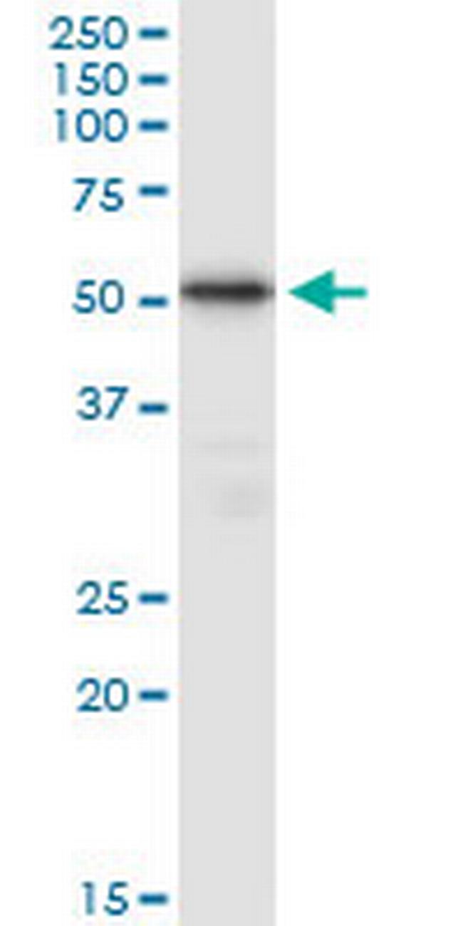 TUBB4Q Antibody in Western Blot (WB)