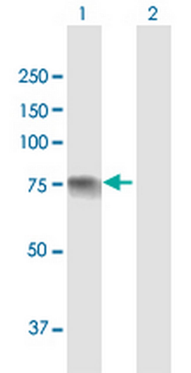 INPP5E Antibody in Western Blot (WB)