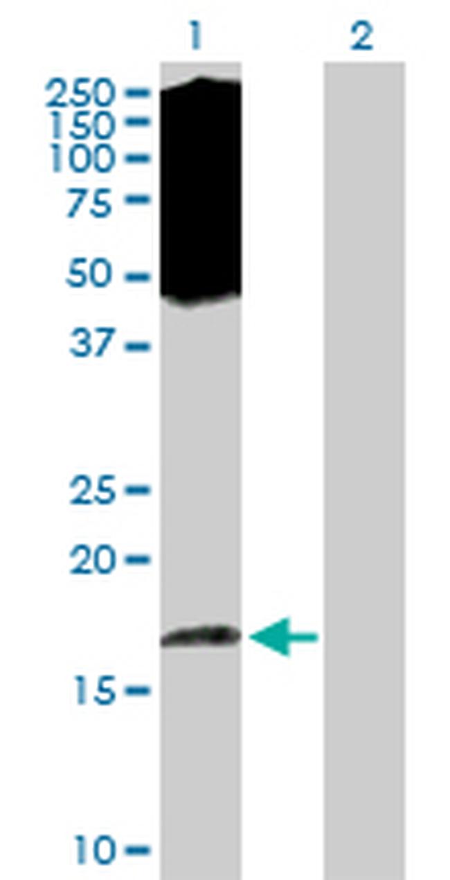 EIF5A2 Antibody in Western Blot (WB)