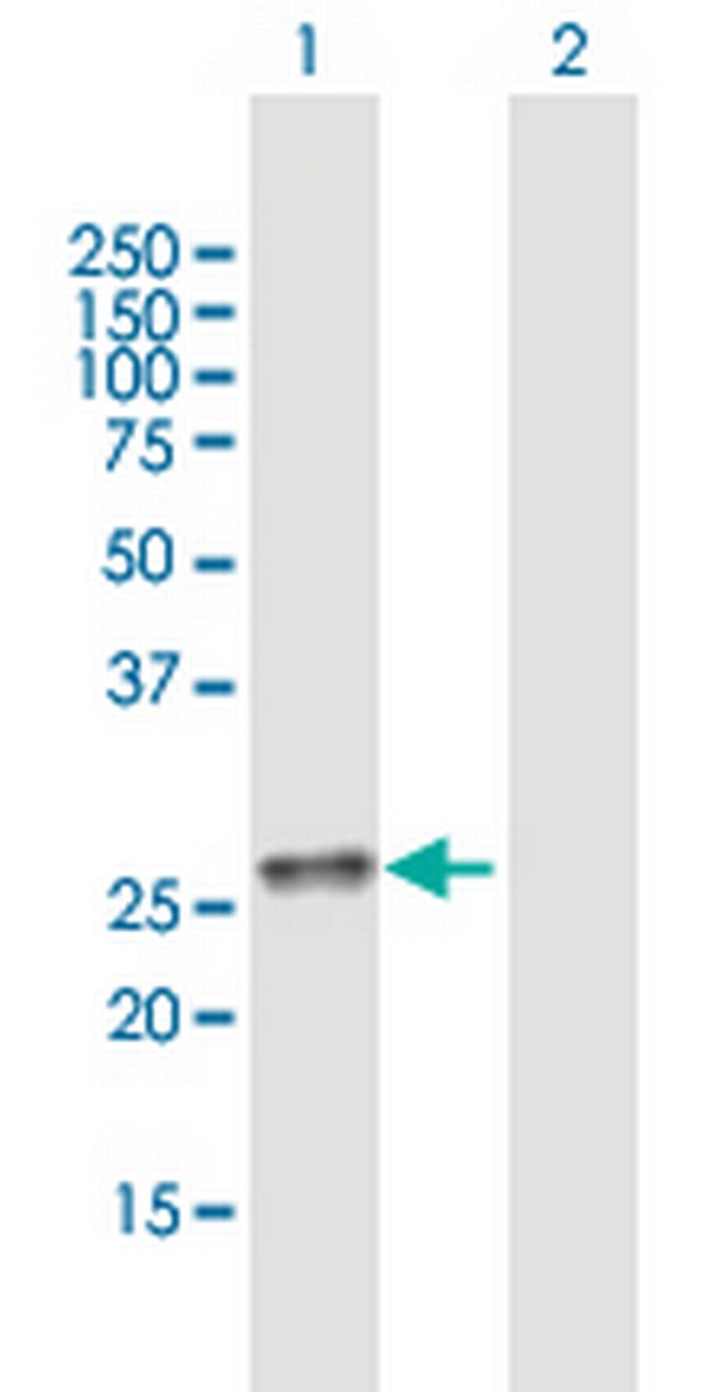 C11orf17 Antibody in Western Blot (WB)