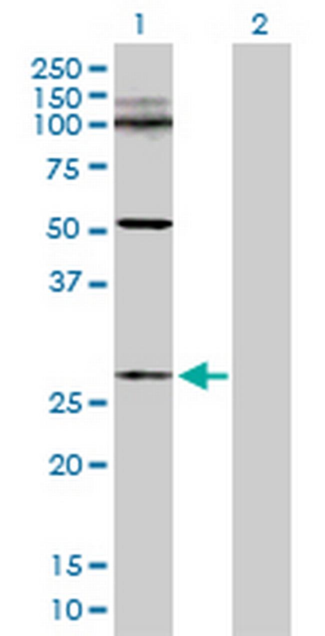 C11orf17 Antibody in Western Blot (WB)