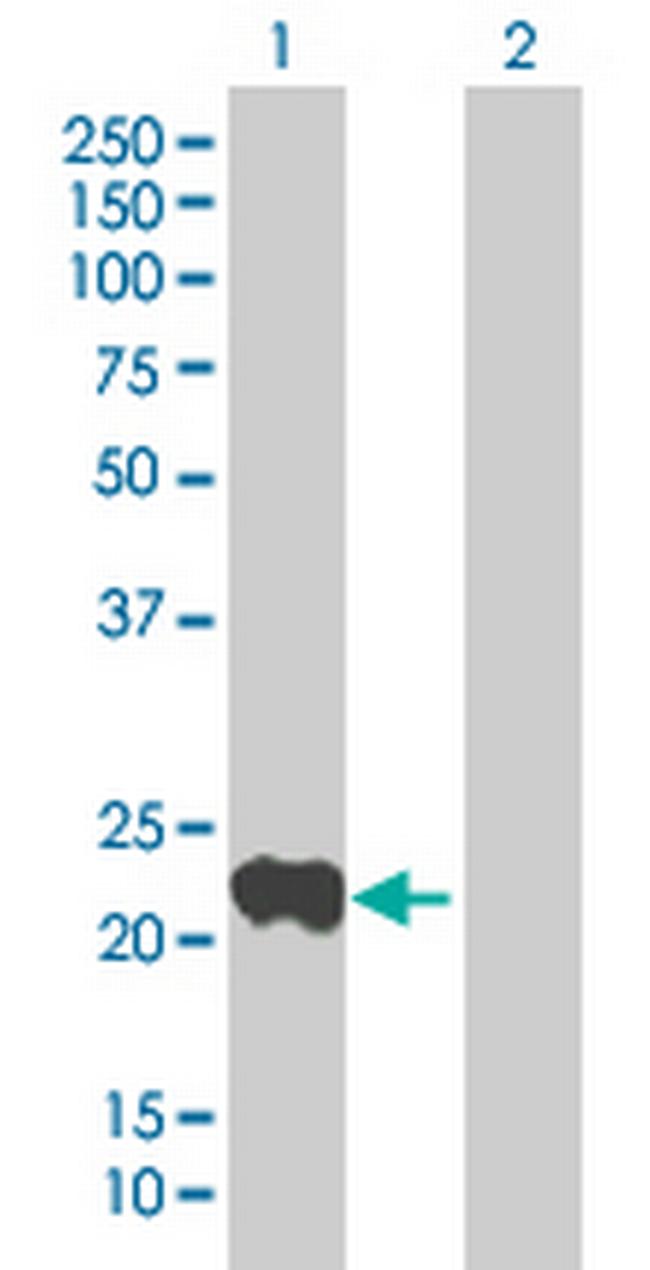 SAR1A Antibody in Western Blot (WB)