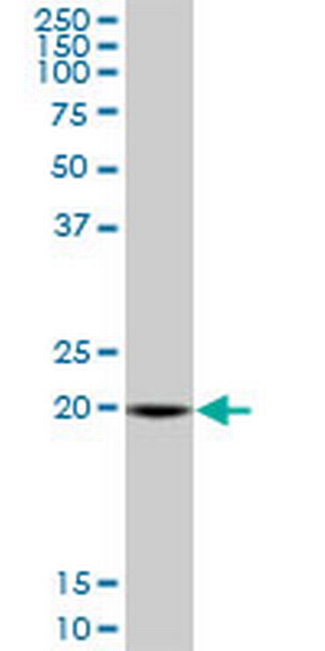 SAR1A Antibody in Western Blot (WB)