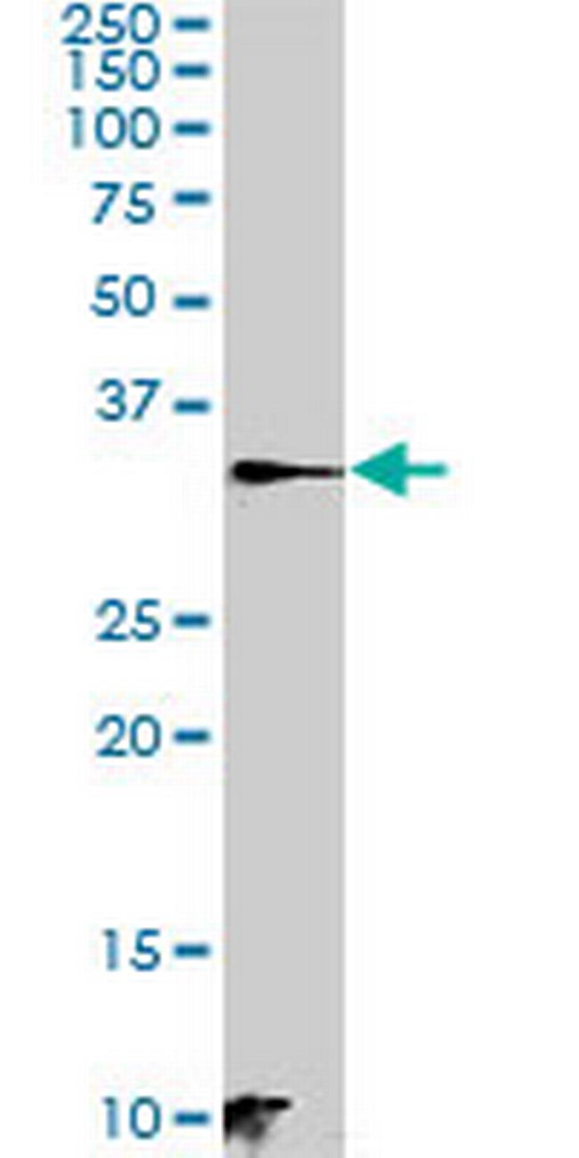 C21orf59 Antibody in Western Blot (WB)