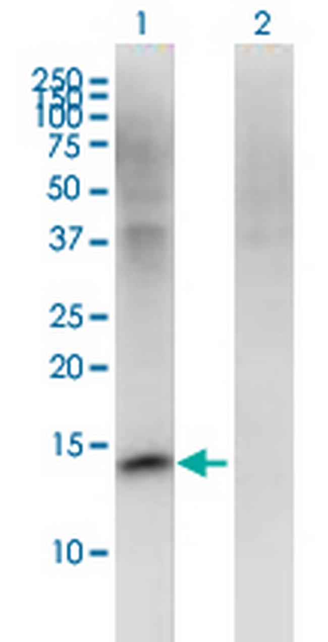 FMN2 Antibody in Western Blot (WB)
