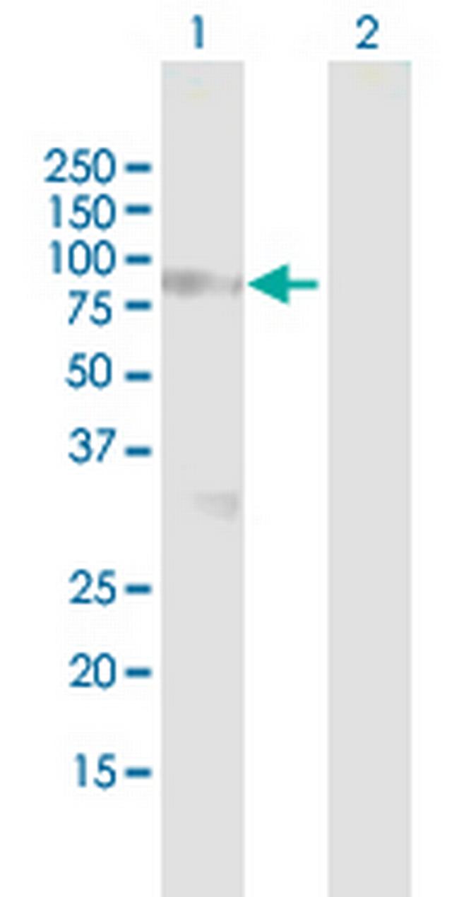 SPHK2 Antibody in Western Blot (WB)