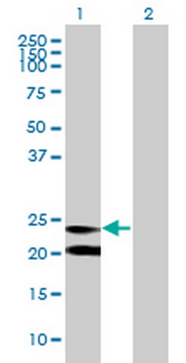 C15orf24 Antibody in Western Blot (WB)