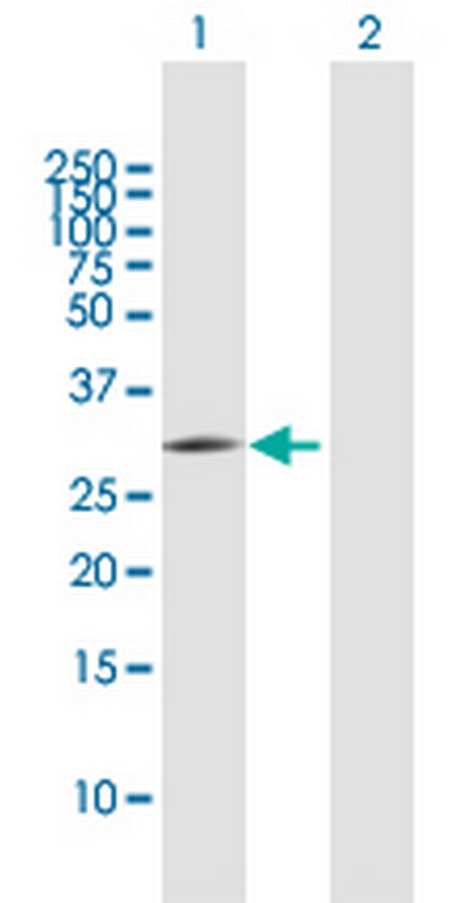 PNO1 Antibody in Western Blot (WB)