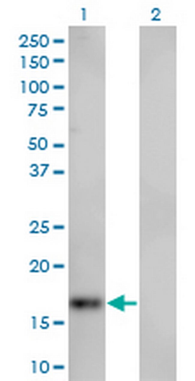 SPIRE1 Antibody in Western Blot (WB)
