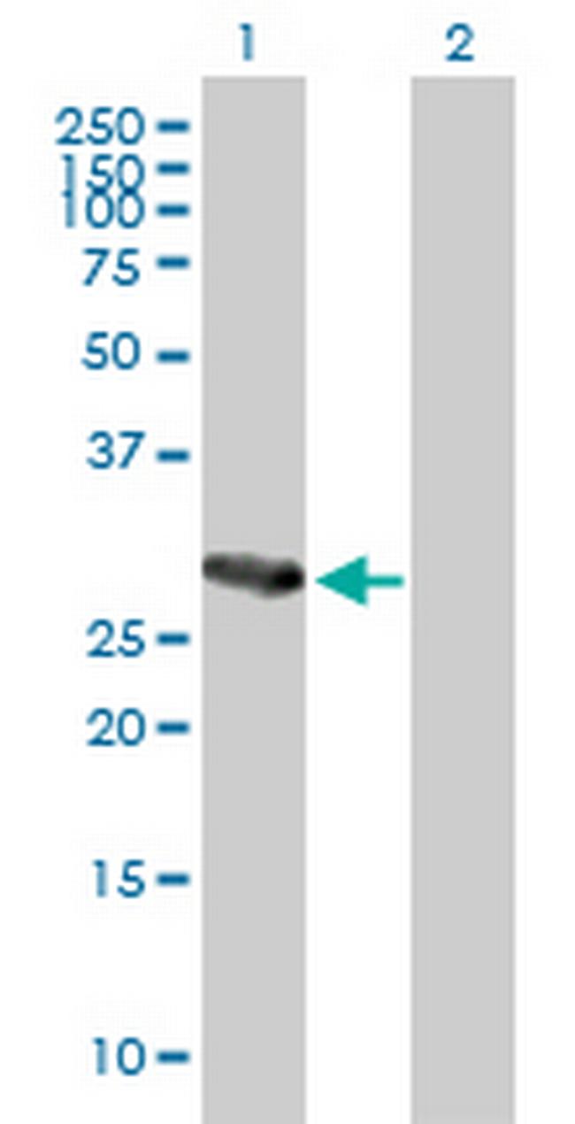 C21orf7 Antibody in Western Blot (WB)